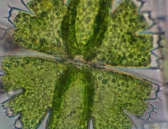 Micrasterias brachyptera thumbnail 4