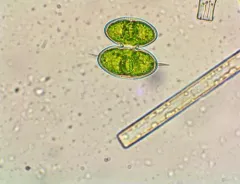 Staurodesmus convergens thumbnail 2
