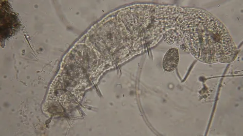 Chaetogaster limnaei