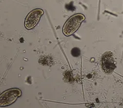 Colpidium colpoda thumbnail 2