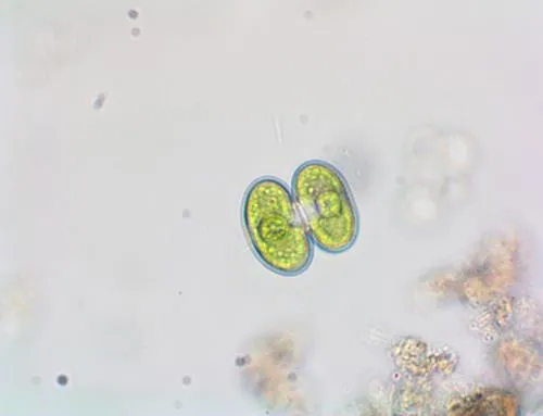 Cosmarium phaseolus