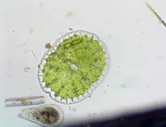Micrasterias denticulata thumbnail 1