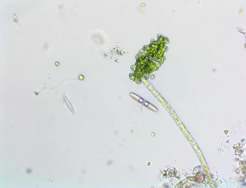 Euastrum humerosum