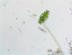 Euastrum humerosum thumbnail 1