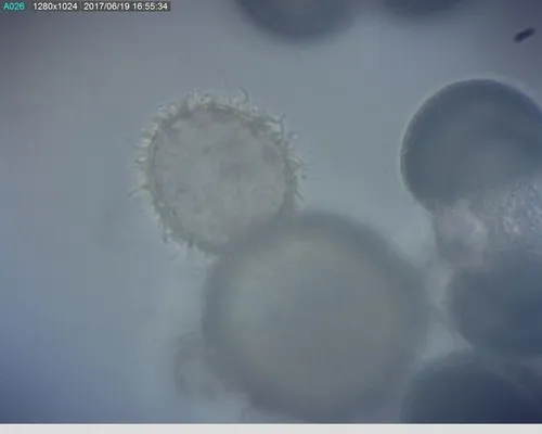 Rhizophydium echinocystoides