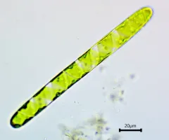 Spirotaenia condensata thumbnail 2