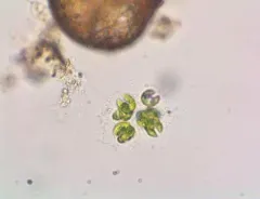 Kirchneriella obesa thumbnail 4