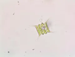 Scenedesmus quadricauda thumbnail 2