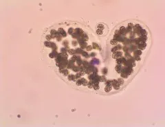 Microcystis wesenbergii thumbnail 2