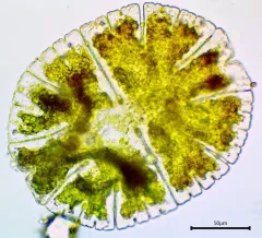 Micrasterias denticulata thumbnail 2