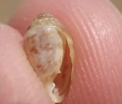 Two-toothed Marsh Snail thumbnail 3