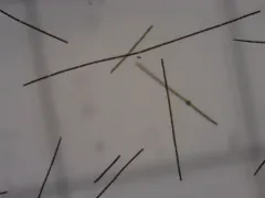 Dolichospermum planctonicum thumbnail 4