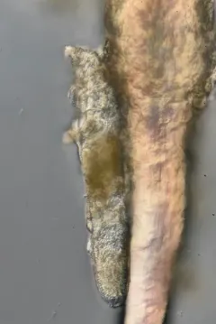 Human Follicle Mite thumbnail 2