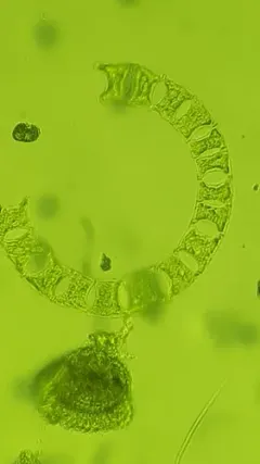 Eucampia zodiacus thumbnail 3