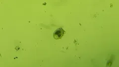 Dinophysis acuminata thumbnail 3