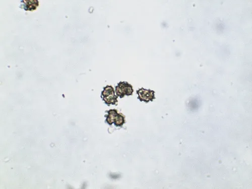 Thelephora anthocephala