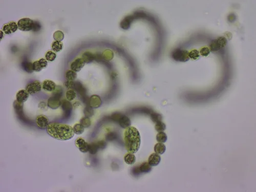 Dolichospermum flosaquae