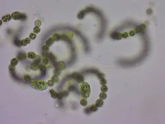 Dolichospermum flosaquae thumbnail 1