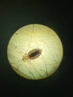 Dog Sucking Louse thumbnail 2