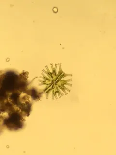 Micrasterias furcata thumbnail 2