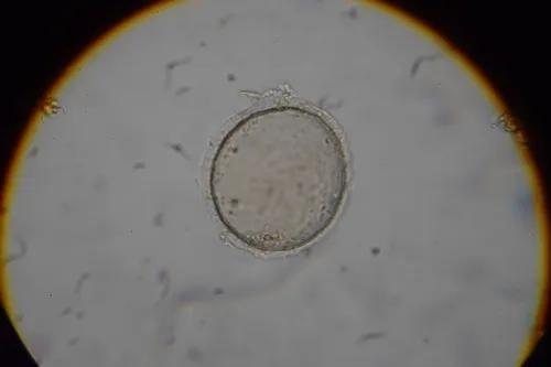 Microchlamys patella