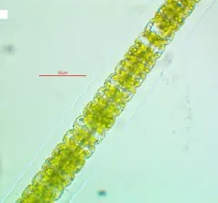 Hyalotheca dissiliens thumbnail 2