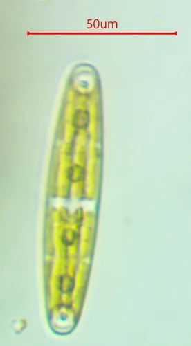 Closterium navicula