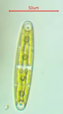 Closterium navicula thumbnail 1